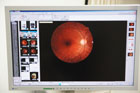 患者さまの眼の様々な画像を、保存・分析する画像ファイリングシステムです。